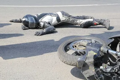 Ужасные последствия мотоциклетной аварии