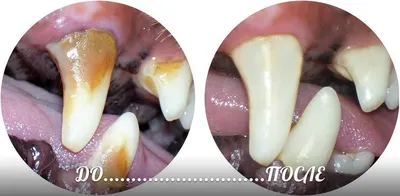 Пародонтит и воспаление дёсен у собак