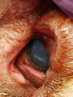Проптоз (выпадение) глазного яблока/ Proptosis of eyeball