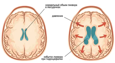 Первичные новообразования головного мозга у животных. Ветеринарные центры  \"Котонай\"