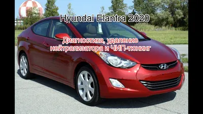 Hyundai Elantra MD, установка ПТФ - примеры работ тюнинг-центра CarHeart |  Санкт-Петербург