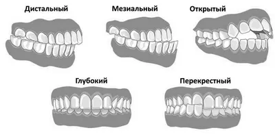 Когда у собак выпадают зубы? | Блог на VetSpravka.ru