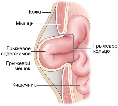 Паховая грыжа у собак: симптомы, лечение