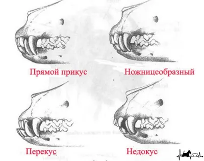 Исправление прикуса ортодонтическим способом (установка брекет-систем)
