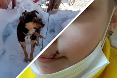 В Новосибирской области соседский пес разорвал школьнице губу - KP.RU