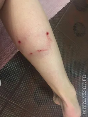 Раны от укусов собаки фото 