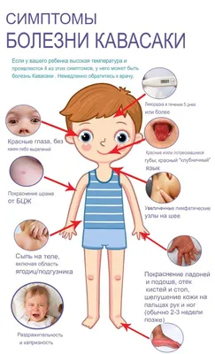 Синдром Кавасаки - редкое детское заболевание, про которое нельзя забывать  | Всего понемногу: о медицине и вокруг неё | Дзен
