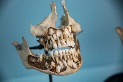 Что делать, если у собаки выпал зуб | Описание причины и профилактики  выпадения зубов у собак - Petstory