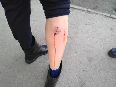Горожанка рассказала о нападении стаи бродячих собак на школьника возле  Шехурдина
