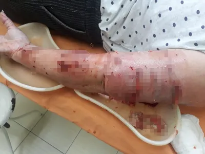 В Днепре девушке пришлось просить ветеринаров зашить ей руку после укуса  собаки - Новости на KP.UA
