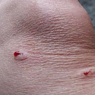 Маленькому севастопольцу грозит пересадка кожи после нападения собаки |  19.05.2022 | Севастополь - БезФормата