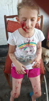 В Балаково на рынке \"Рокот\" собака укусила девочку. Пострадавшая  госпитализирована