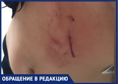 Жительницу Воронежа укусила собака — Интернет-канал «TV Губерния»