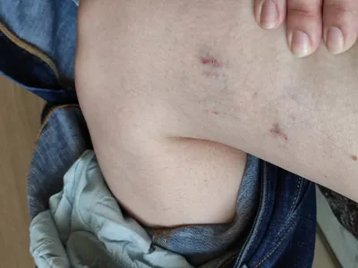 В Астрахани трехлетнюю девочку укусила собака | АРБУЗ