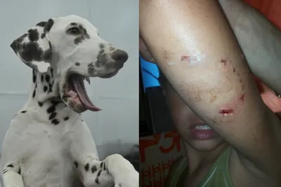 В Марий Эл 243 детям после укусов собак понадобилась медпомощь | Новости  Йошкар-Олы и РМЭ
