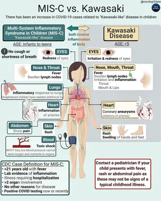 Long-term Consequences of Kawasaki Disease | Circulation